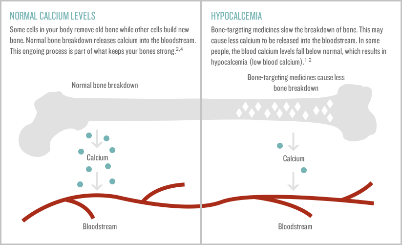 NORMAL CALCIUM LEVELS Some cells in your body remove old bone while other cells rebuild new bone. Normal bone breakdown releases calcium into the bloodstream. This ongoing process is part of what keeps your bones strong.3
HYPOCALCEMIA Some bone-targeting medicines slow the breakdown of bone. This may cause less calcium to be released into the bloodstream. In some people, the blood calcium levels fall below normal, which results in hypocalcemia (low blood calcium)1,4,5